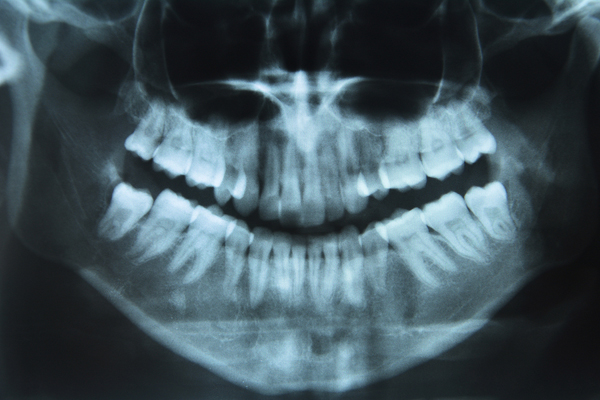 perfect-age-begin-orthodontic-treatment-santa-barbara-ca