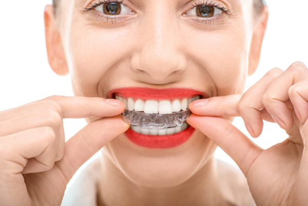 how-long-do-i-have-to-wear-invisalign-goleta-ca